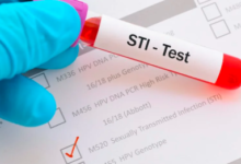 STD Test