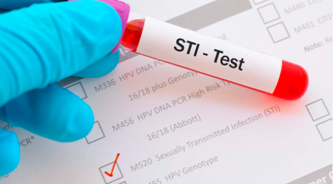 STD Test