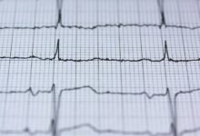 stellar pulse revenue report